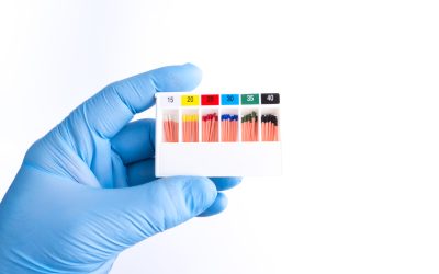 Guttaperca in odontoiatria: cos’è, come si usa e perché è fondamentale nella devitalizzazione