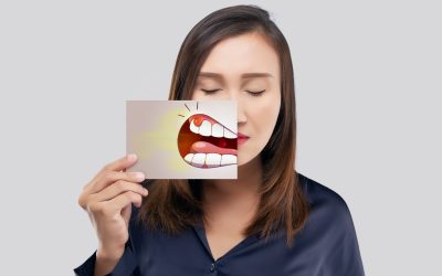 Ascesso dentale: cause, sintomi e come affrontarlo