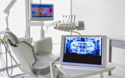 Anestesia del Cavo Orale: Tipologie e durata