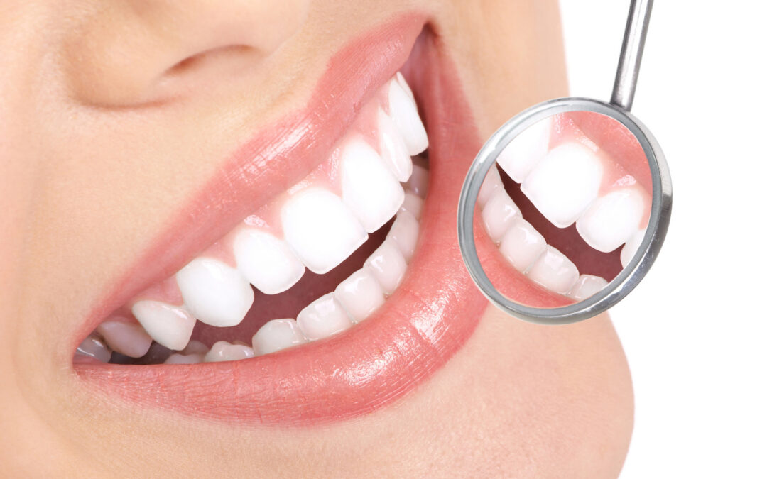 Lavorare di Riflesso: Cos’è e a Cosa Serve lo Specchietto del Dentista
