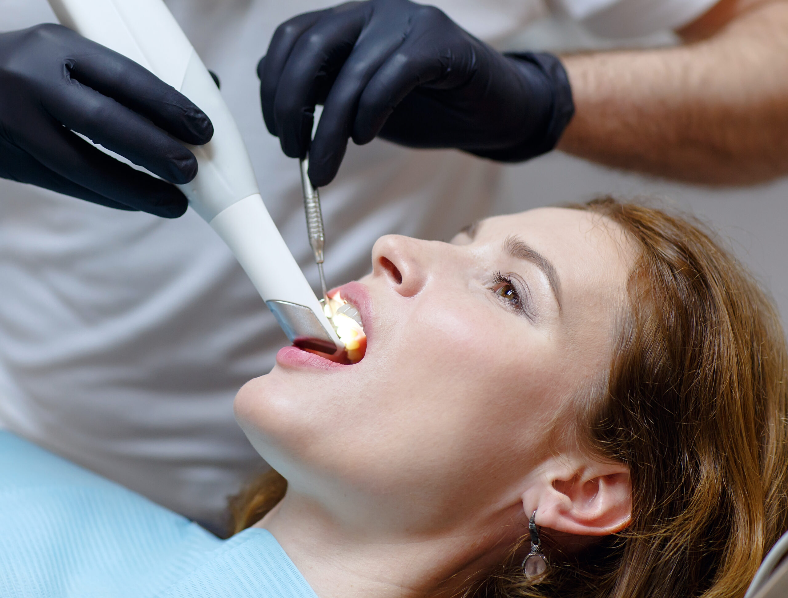Addio al fastidio: l’impronta dentale diventa digitale e in 3D