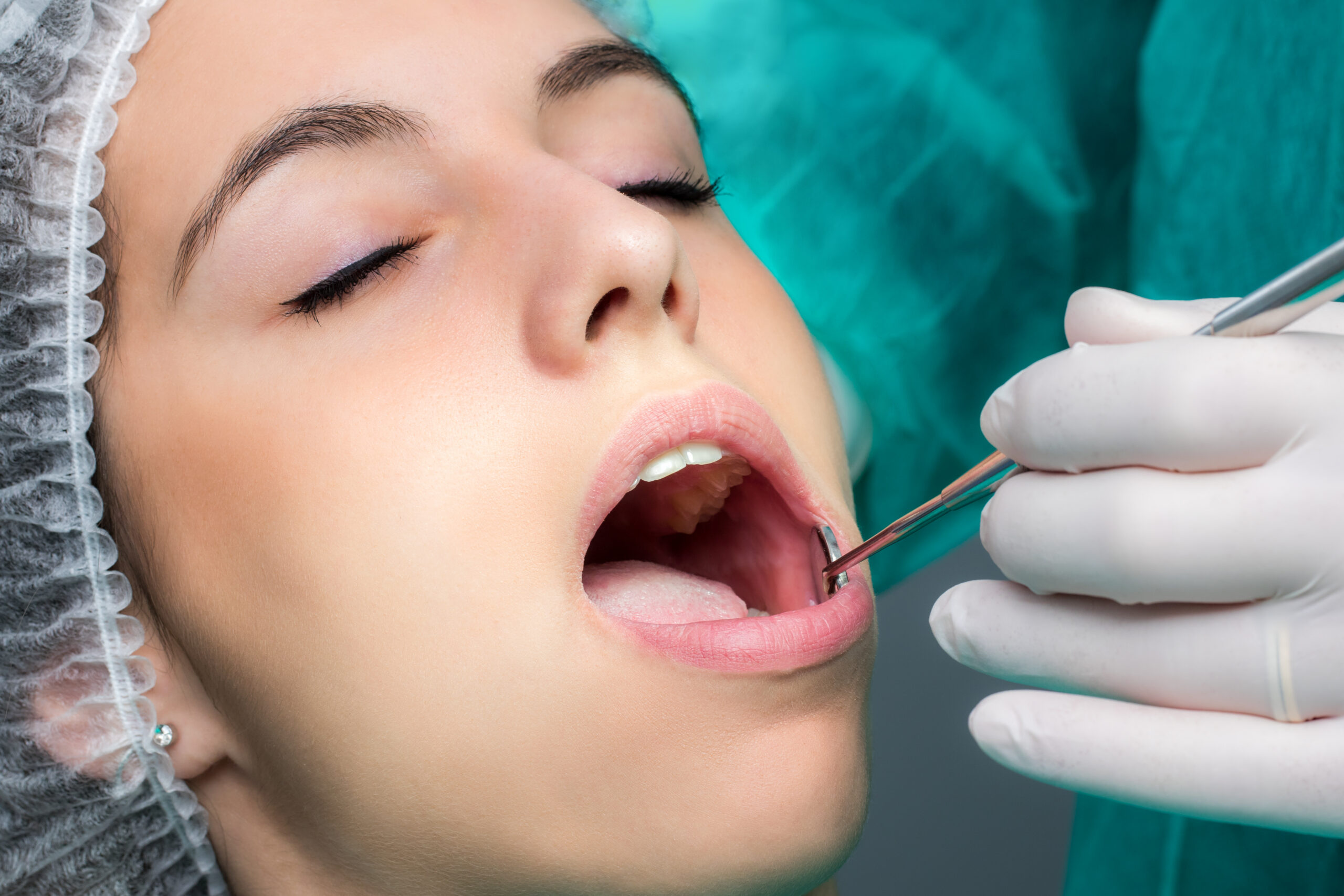 Chirurgia orale: il ruolo del paziente nel post-operatorio
